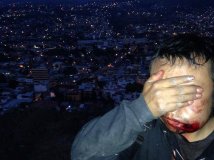 Foto studente ferito a Chilpancingo